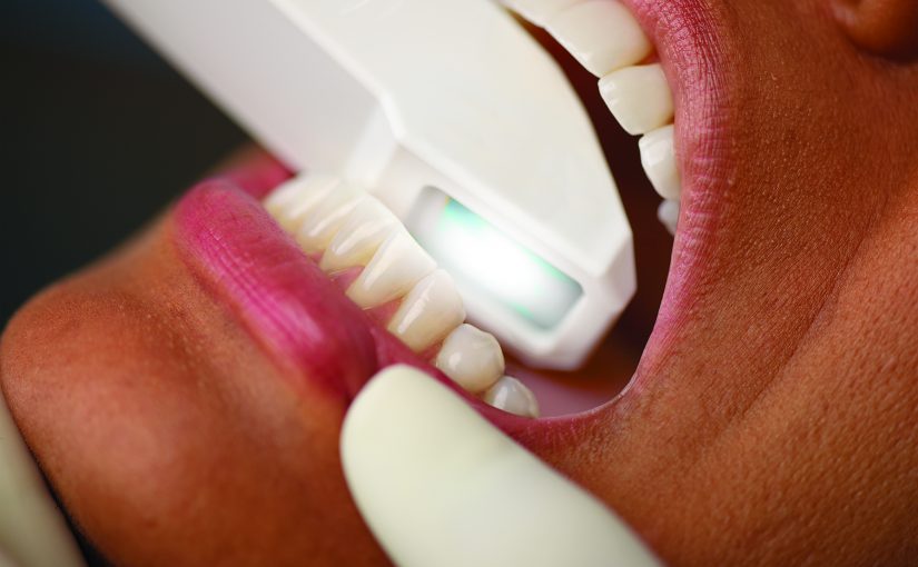 Digital Dentistry Guarantees Your Perfect Smile