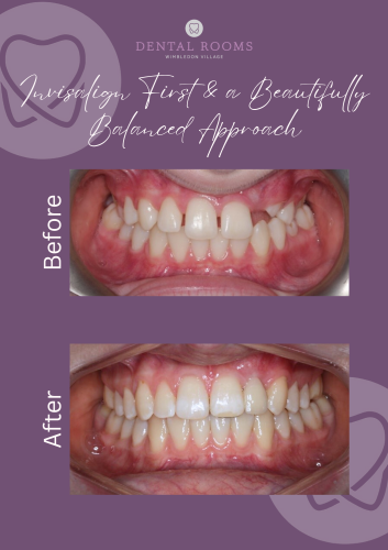 before-after