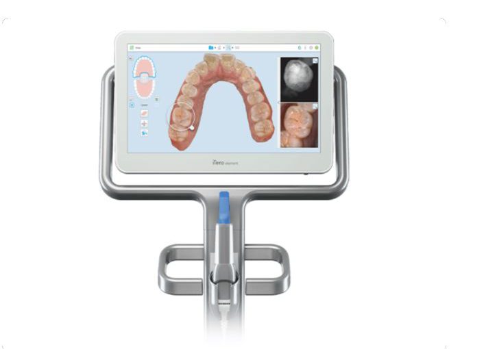 Prevention is Better Than Cure: How Digital Scans Are Revolutionising Dentistry