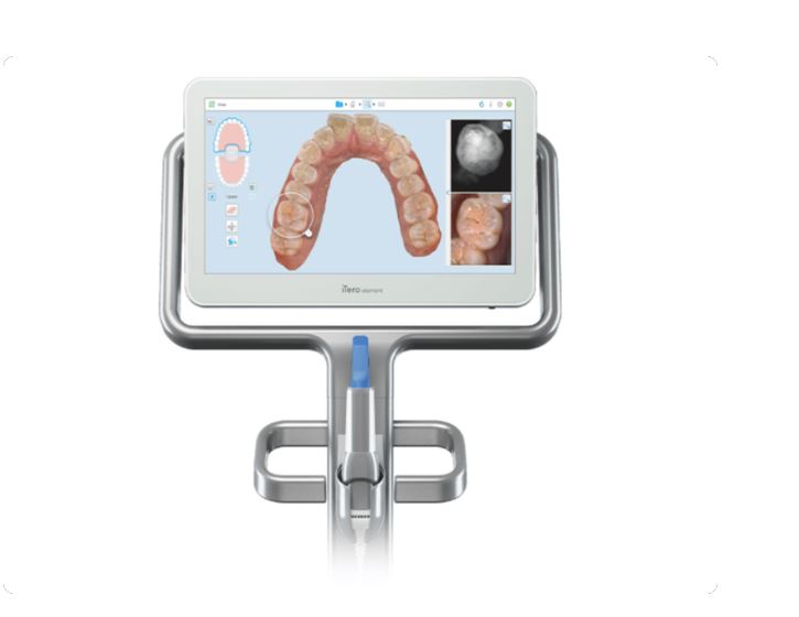 digital-dental-scans