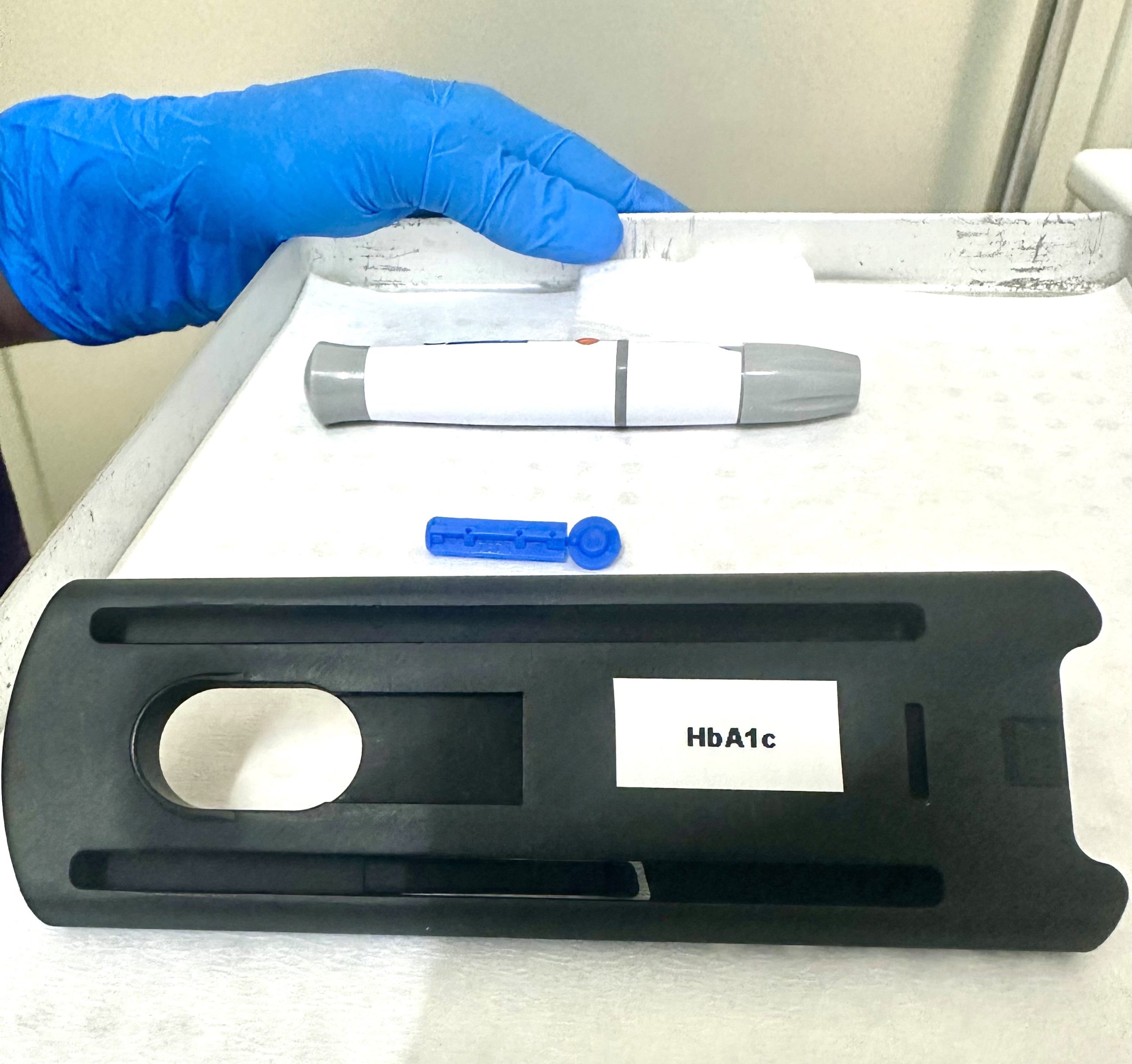 hba1c