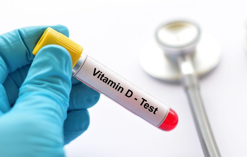 Vitamin D and Oral Health: The Hidden Link to Implants and Gum Health