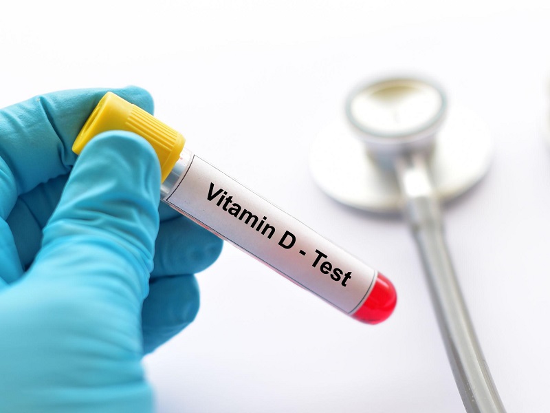 vitamin-d-test-wimbledon