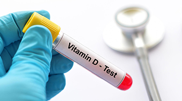Vitamin D